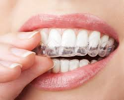 Who Benefits Most from Invisalign Treatment in Selkirk and Sees Faster Results
