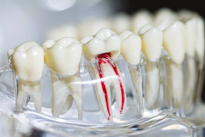 When Tooth Pain Lingers: Guide To Root Canal Care, Recovery, And Prevention